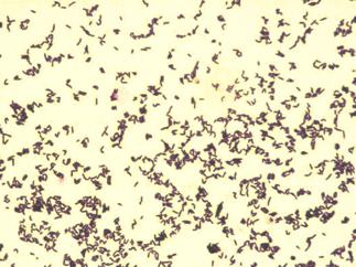 写真８　Corynebacterium bovisのグラム染色所見